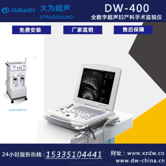 超声妇科手术监视仪 可视人流机 DW-400